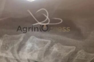 Shock in Agrinio: Hooks "sat down" on the 38 -year -old's esophagus who ate octopus