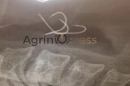 Shock in Agrinio: Hooks "sat down" on the 38 -year -old's esophagus who ate octopus